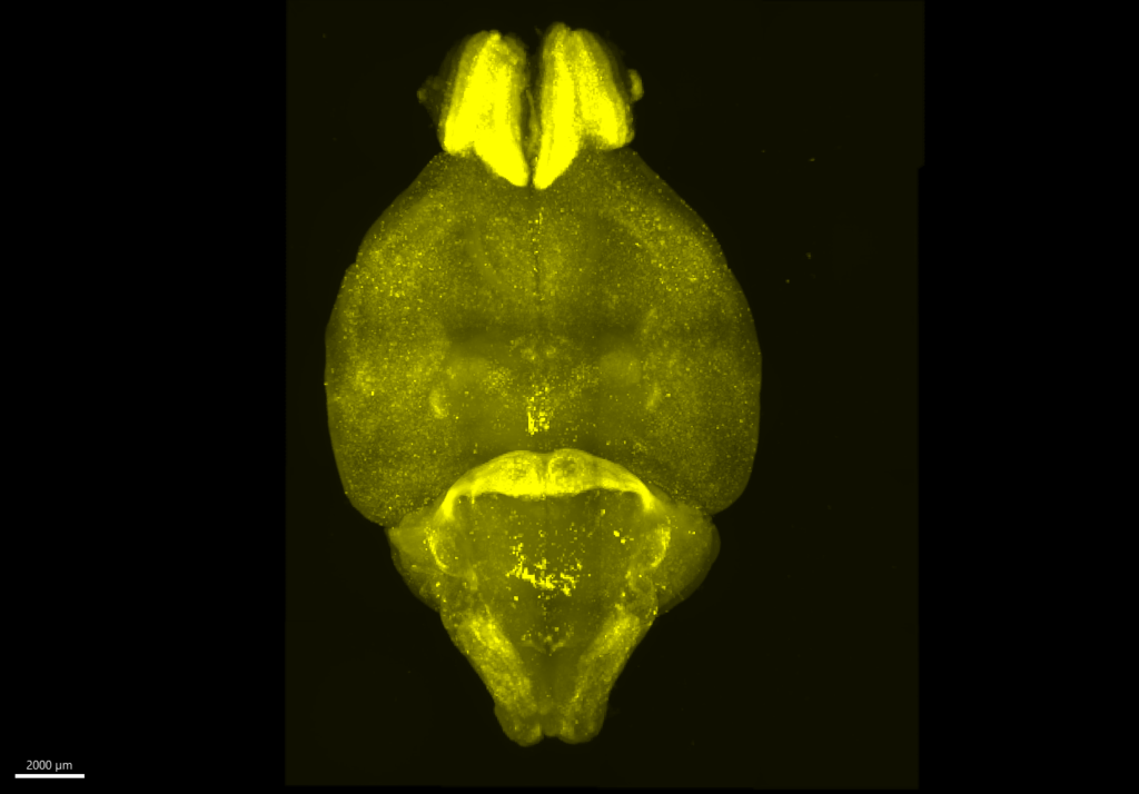 A microscope image shows a top-down view of a mouse brain, which is roughly the shape of a football and glowing yellow. The yellow comes from a tag that highlights which neurons are active. In this image, the neurons at the top tip of the football shape are brightest, as are the neurons in a ridge closer to the bottom third.